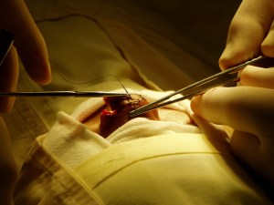 Suturing the nose back in place